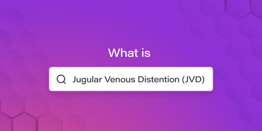 Jugular Venous Distention (JVD): A Comprehensive Guide
